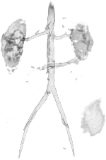 \includegraphics [height=5cm] {images/small_isosurface.eps}