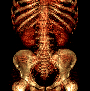 kidney0