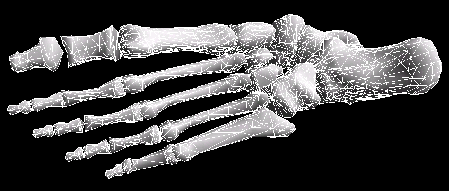 \resizebox{10cm}{!}{ \includegraphics{pic/Bones0.eps} }