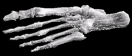 \resizebox{10cm}{!}{ \includegraphics{pic/Bones4.eps} }