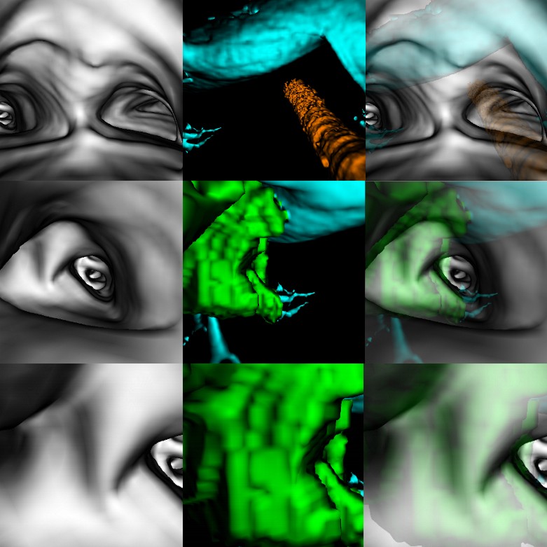 sequence