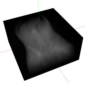 Figure 2: A sample DRR