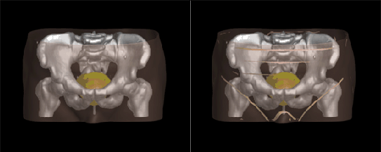 figure108